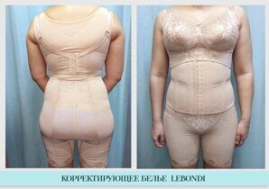 корректирующее белье Lebondi отзывы покупателей до и после (3)